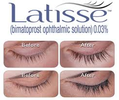 Latisse care